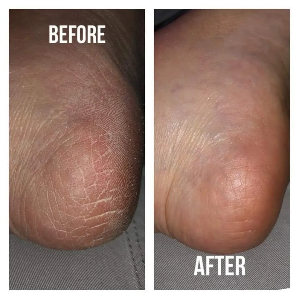 Pedicure in a bottle - Picture 6 of 9